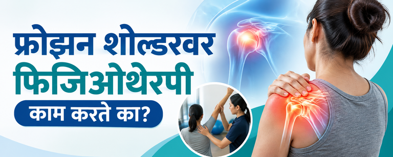 फ्रोझन शोल्डरवर फिजिओथेरपी काम करते का?